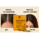 Ампулы Pappa Reale Royal Jelly  против  перхоти и себореи 12шт.Linea Italiana
